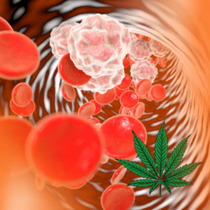 New Study Explores Impact of Dietary Fibers on Prostate Cancer Growth