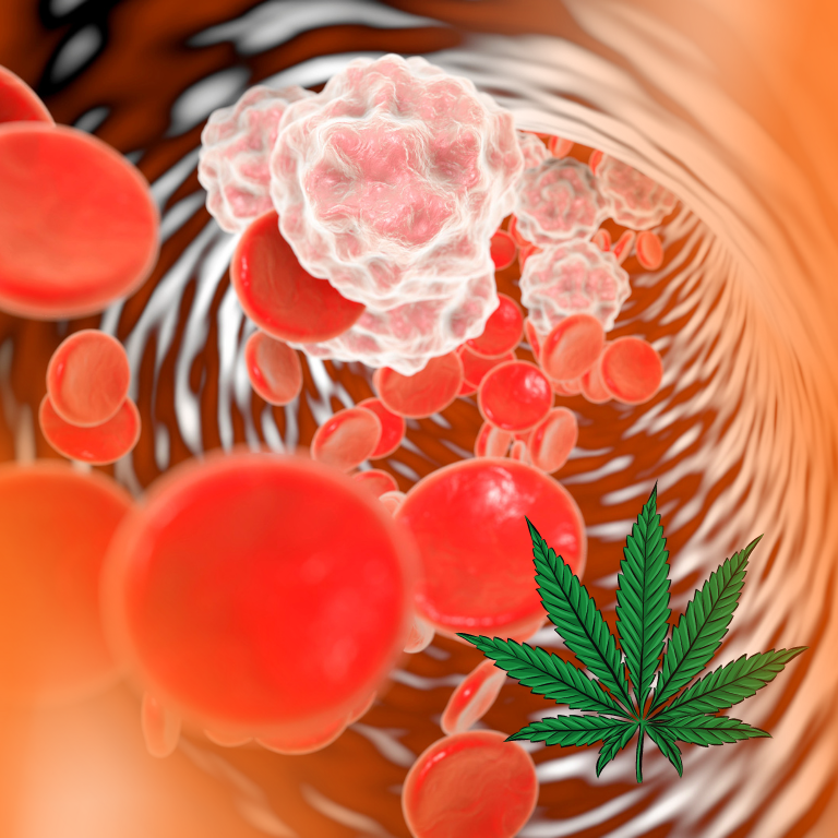 New Study Explores Impact of Dietary Fibers on Prostate Cancer Growth